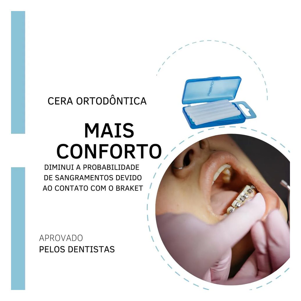 Cera Ortodôntica para Aparelho Proteção Labios 50 Bastões