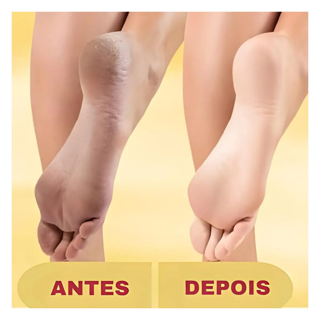 Lixa Elétrica Pés Pedicuro Removedor Calos E Rachaduras + Creme Esfoliante