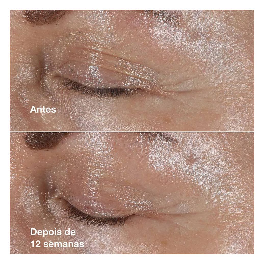 Creme Antirrugas Clinique Smart Repair Para Área dos Olhos 15ml