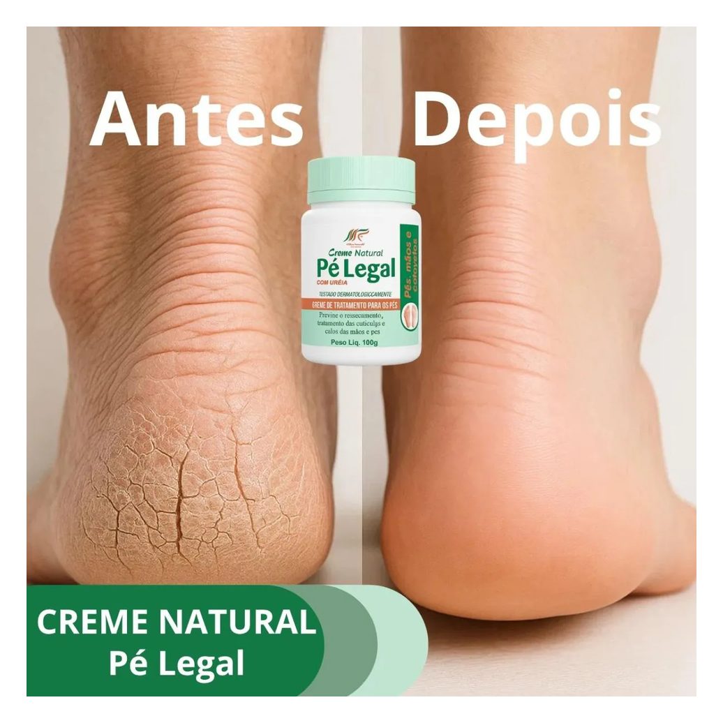 Creme de Uréia para Pés e Cotovelos Hidratação Intensa