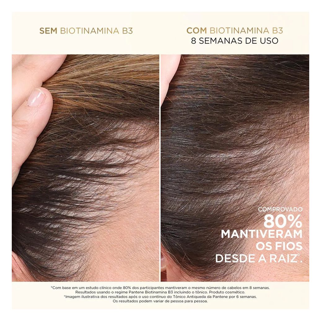 Tônico Capilar Antiqueda Pantene Pro-V Biotinamina B3 52ml