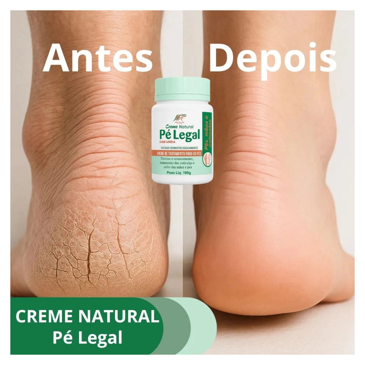 Creme de Uréia para Pés e Cotovelos Hidratação Intensa